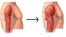 Sarcodyn crecimiento de masa muscular