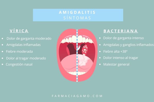 cómo detectar los síntomas de anginas y amigdalitis