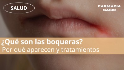 Qué son las boqueras y como curarlas